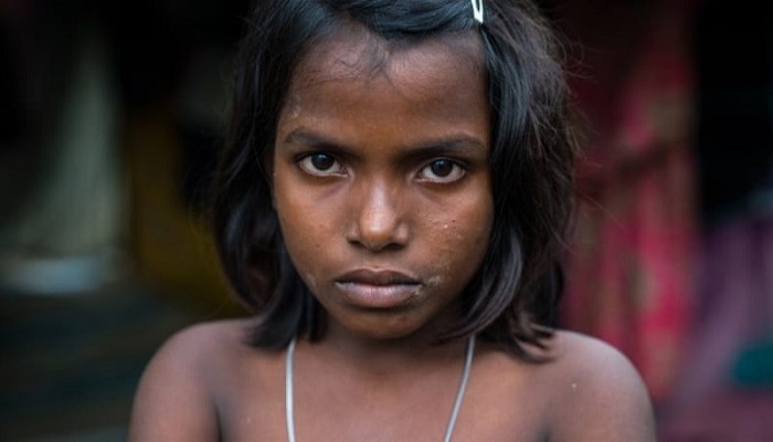 হে বিশ্ববাসী, আমি ‘নূর কাজল’ রোহিঙ্গা বলছি