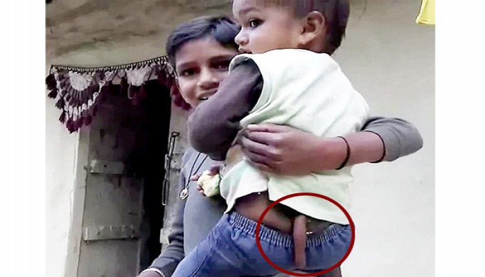 লেজওয়ালা শিশু