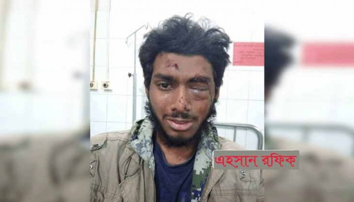 ক্যালকুলেটর ফেরত চাওয়ায় ছাত্রলীগের পিটুনিতে চোখ হারাতে বসেছে ঢাবি শিক্ষার্থী